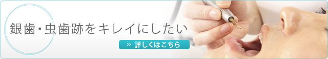 銀歯・虫歯跡をキレイにしたい